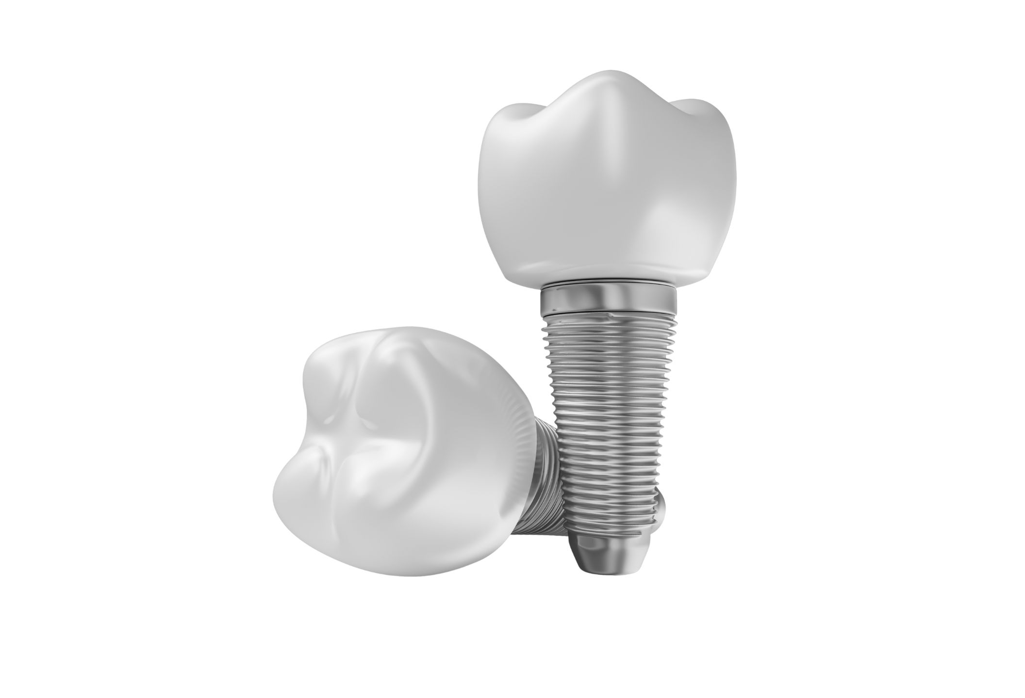 Dental-Implants