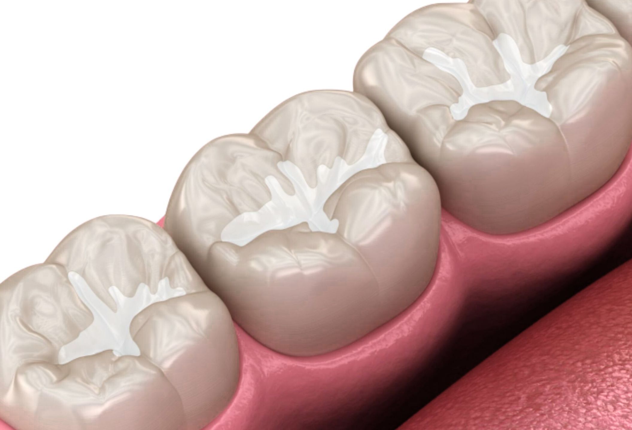 Sealants