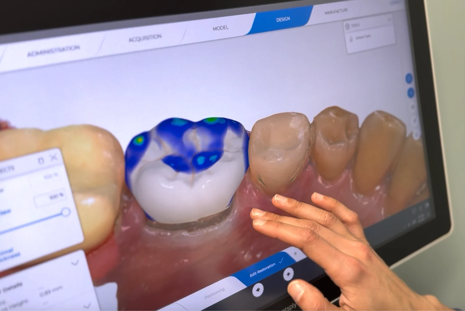 CEREC-same-day-crowns